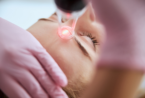 Séance de laser genesis traitement visage