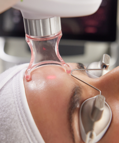 Laser CO2 secret pro